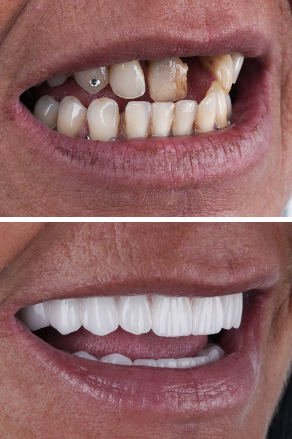 Ömer İstanbul — case