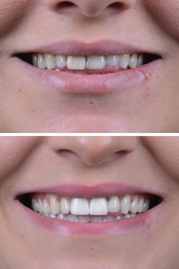 Palm Dental Clinic — case