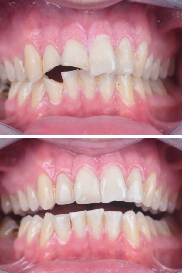 Palm Dental Clinic — case