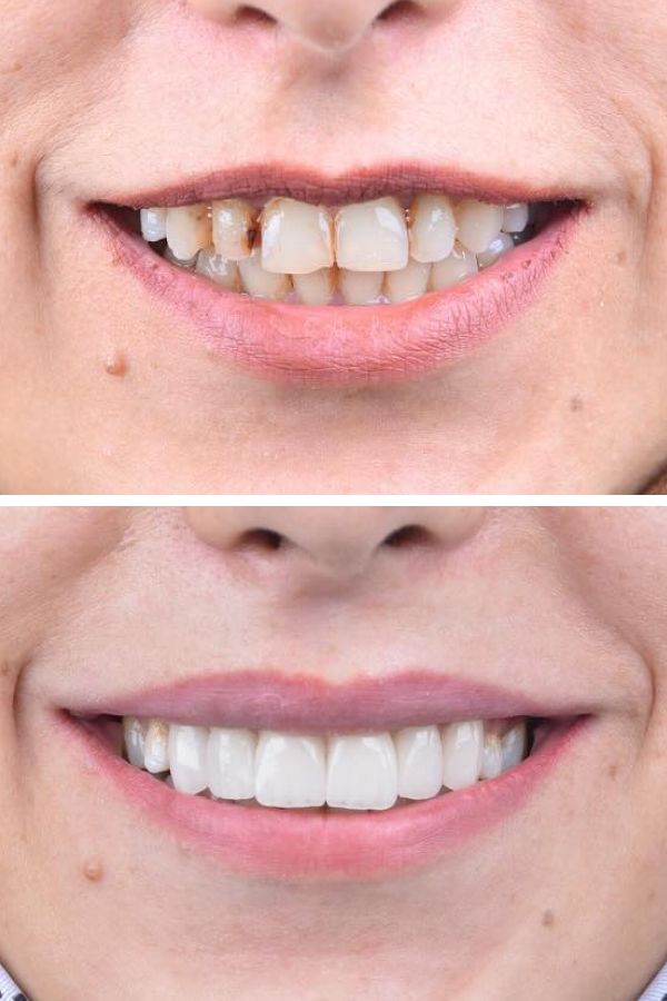 Palm Dental Clinic — case