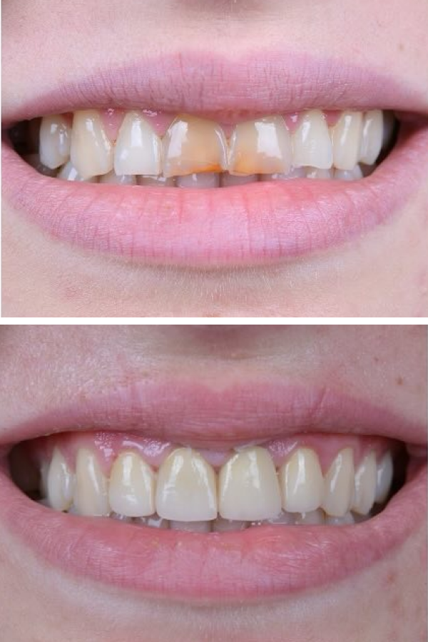 Palm Dental Clinic — case