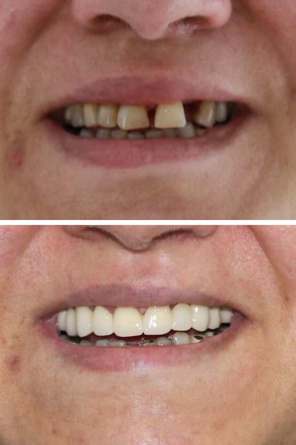 Palm Dental Clinic — case