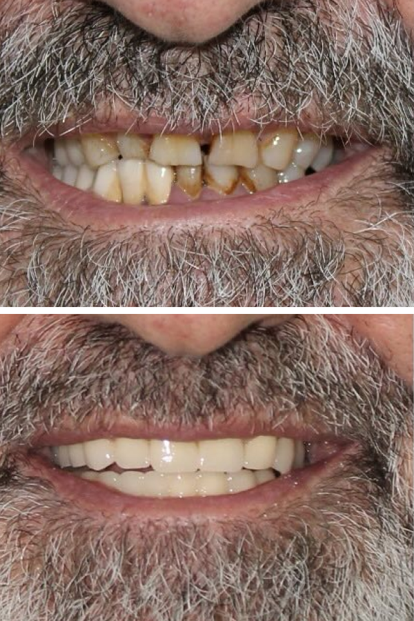 Palm Dental Clinic — case