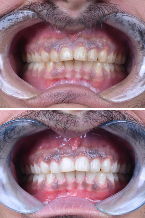 Palm Dental Clinic — case