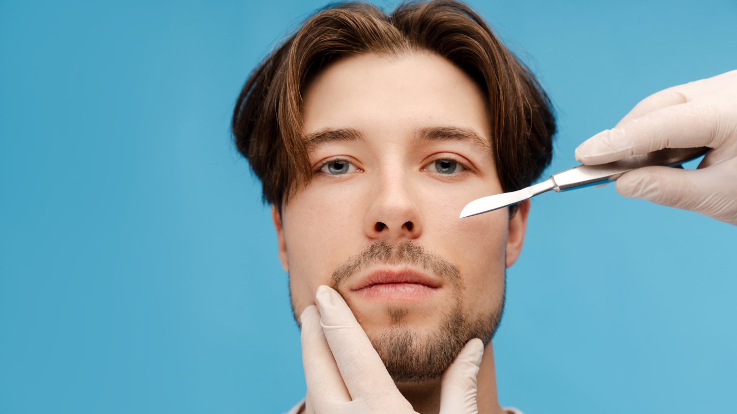 Beard Transplantation: Frame Your Face background