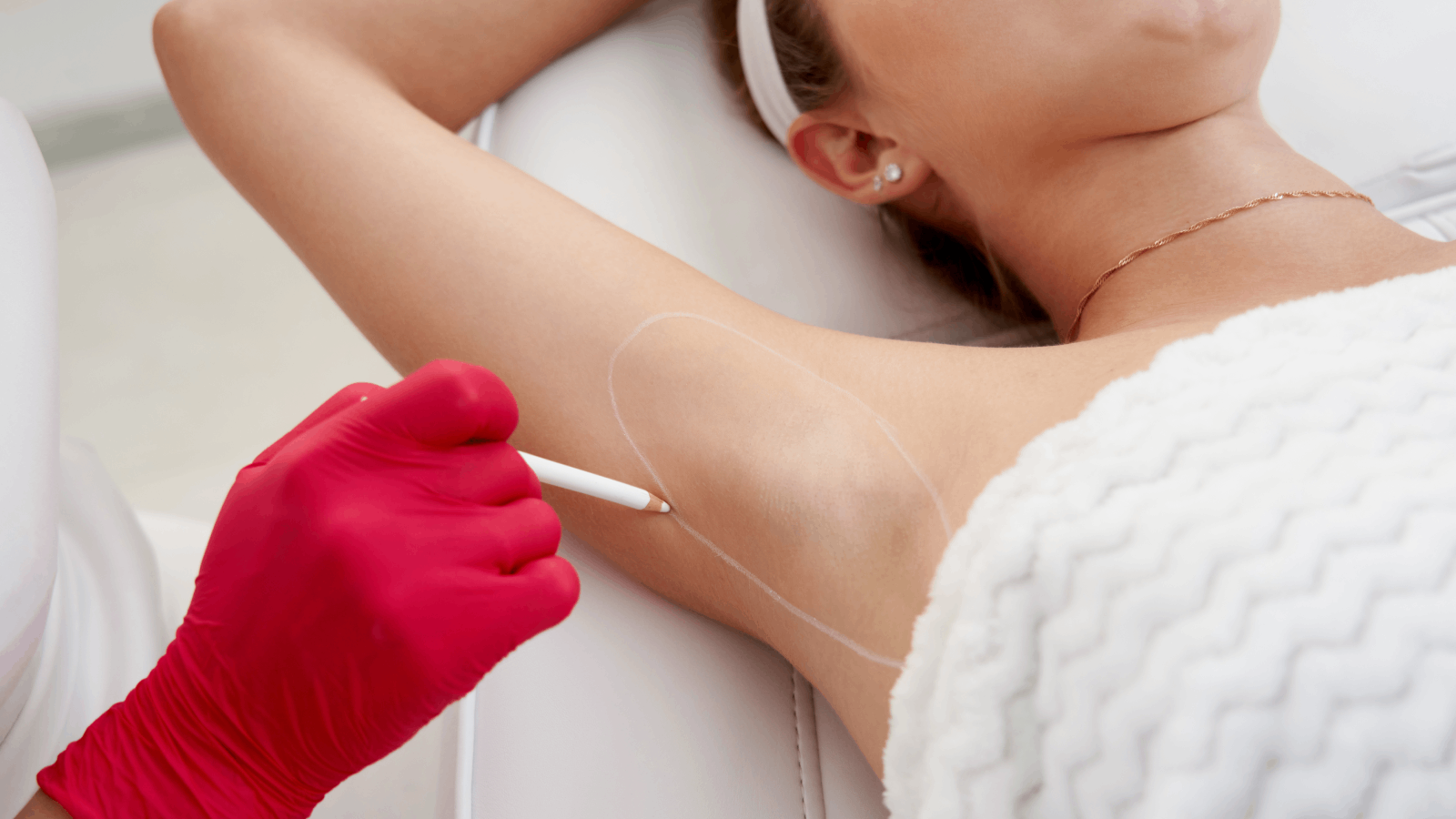 Hyperhidrosis Treatment (Excessive Sweating): Stay Dry, Stay Confident background