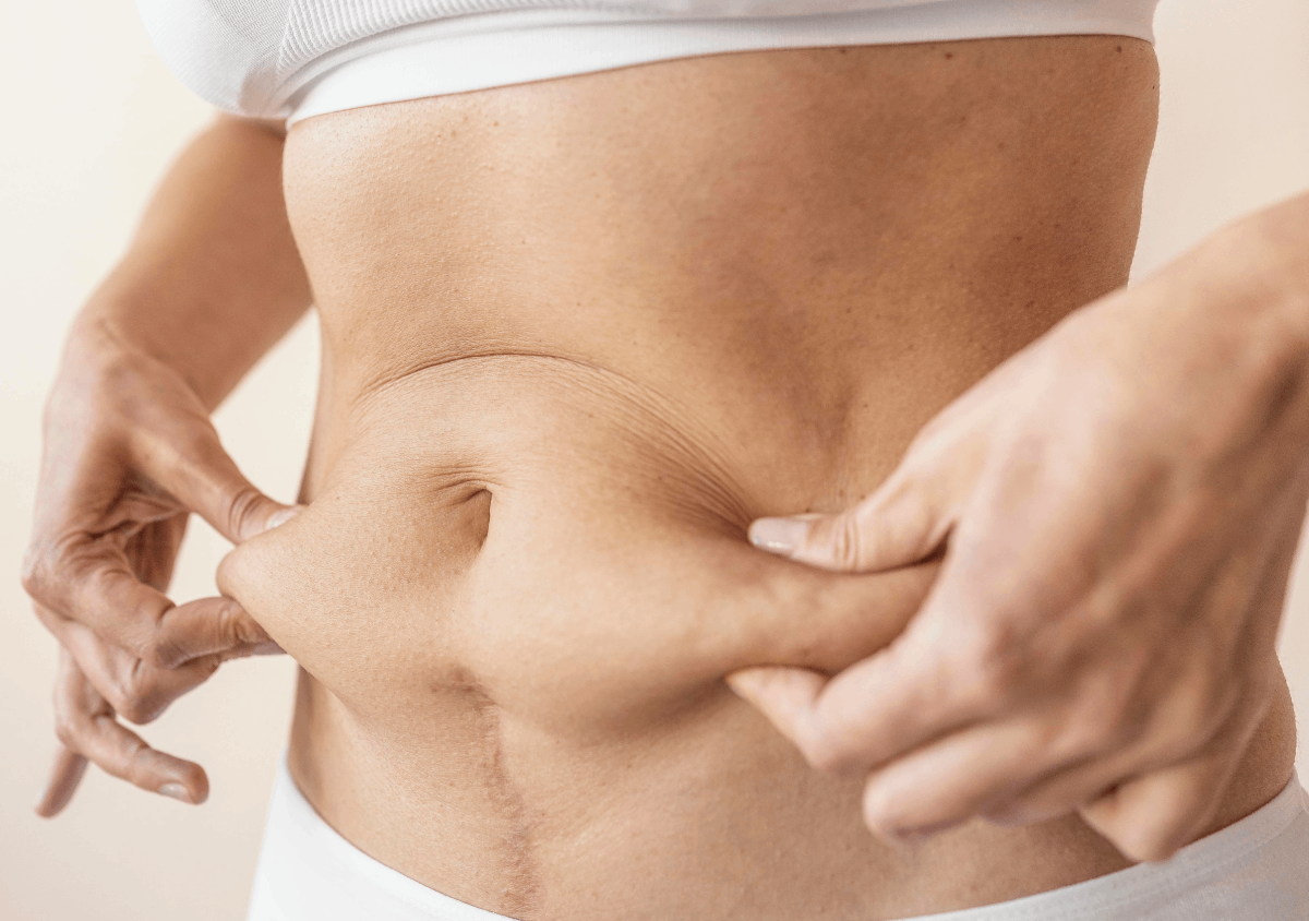 Liposuction: Shape Your Silhouette background