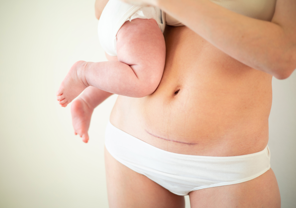 Mommy Makeover: Rediscover Your Radiance background