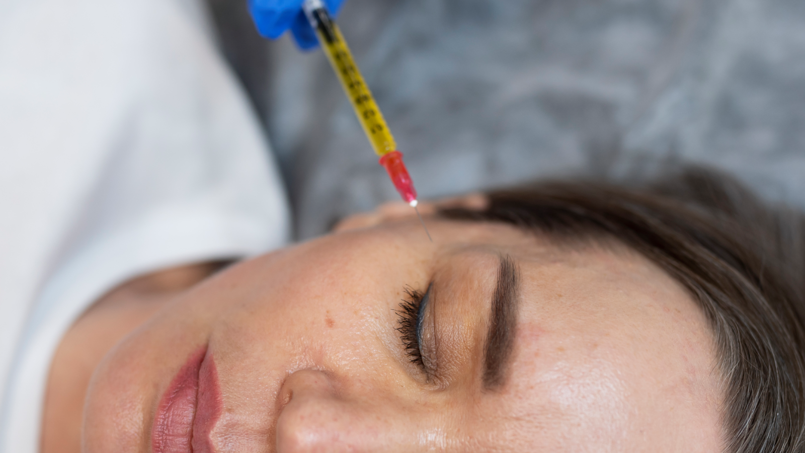 PRP Facial Rejuvenation: Refresh Your Radiance background