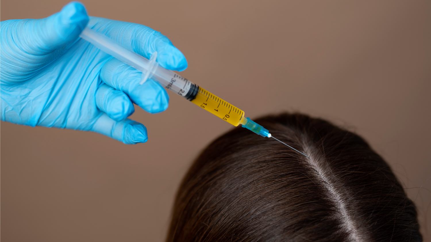 PRP Hair Therapy: Revitalize Your Roots background