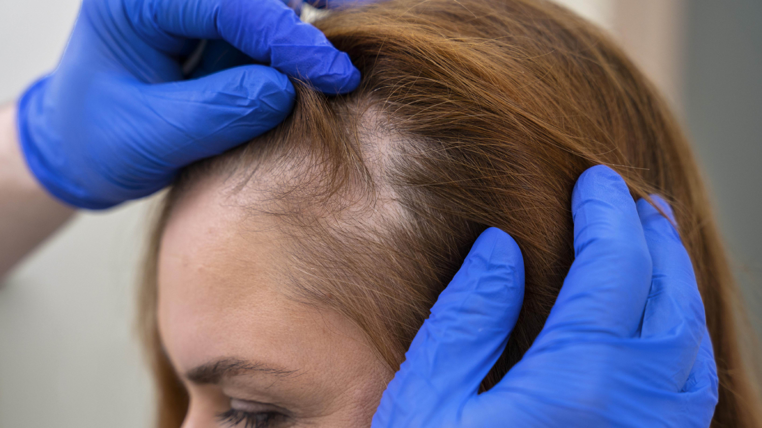Regenera Activa: Revitalize Your Roots background