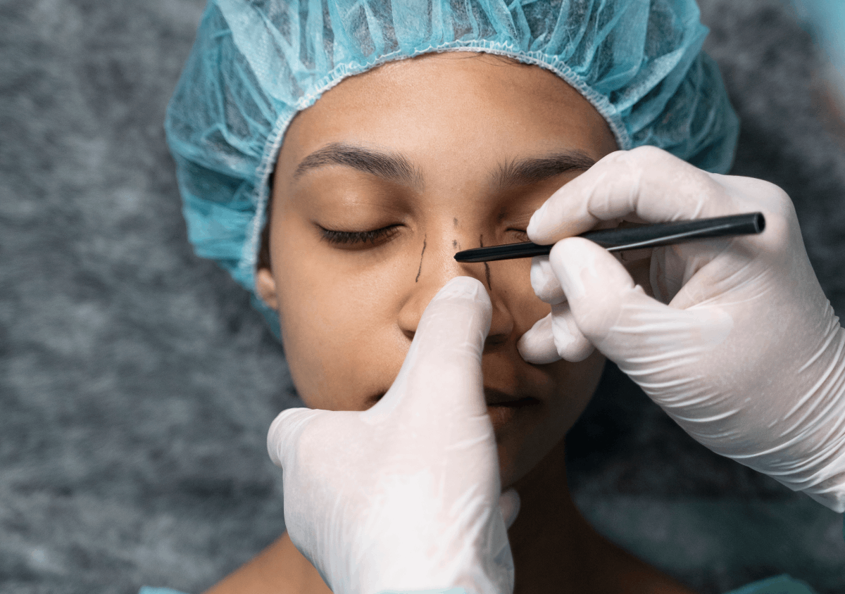 Revision Rhinoplasty: Refine Your Profile background