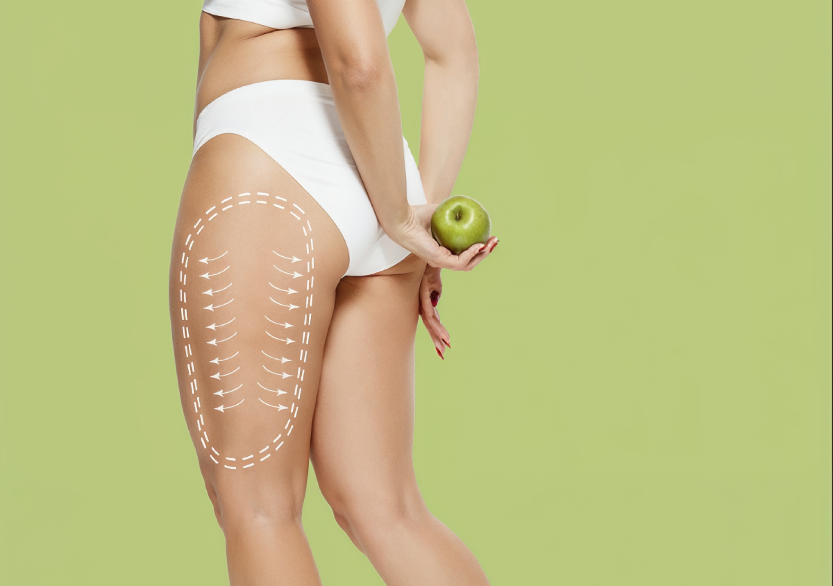 Thigh Lift: Sculpted Thighs Instantly background