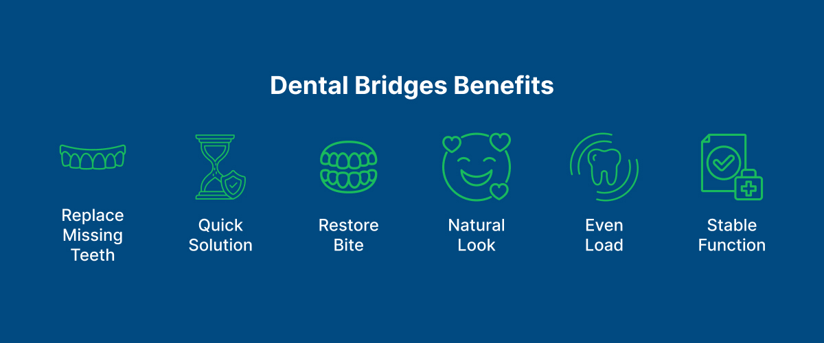 Dental Bridges