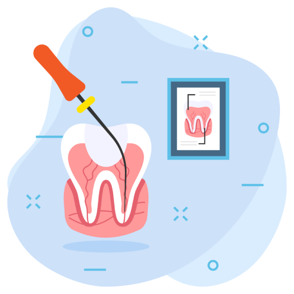 Dental Scaling (Tartar Removal)
