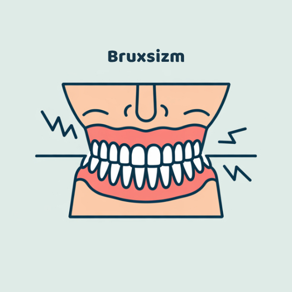 Teeth Grinding Treatment (Bruxism)