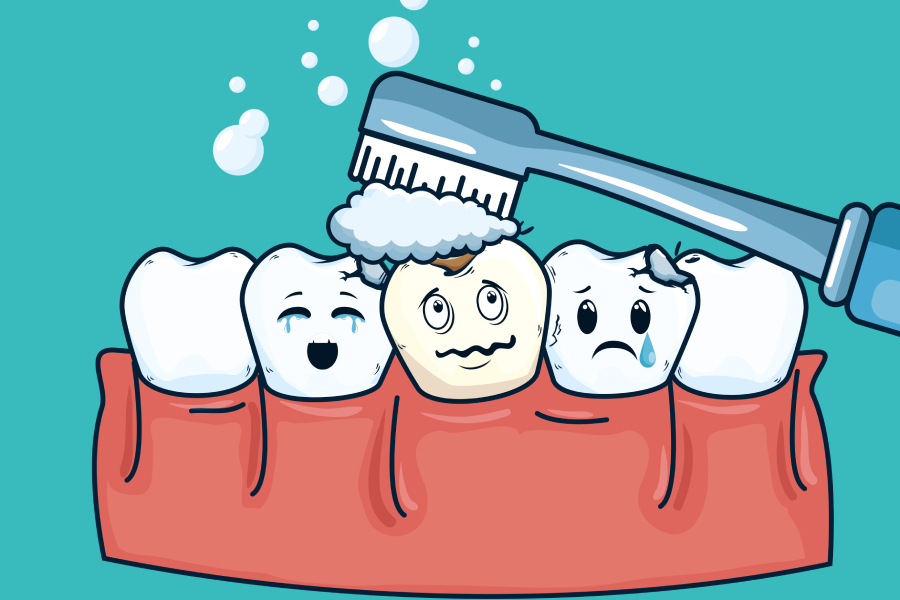 Dental Scaling (Tartar Removal) 3