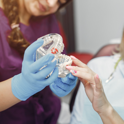 All-on-4 Dental Implants