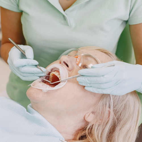 PFM Crown (Porcelain-Fused-to-Metal)