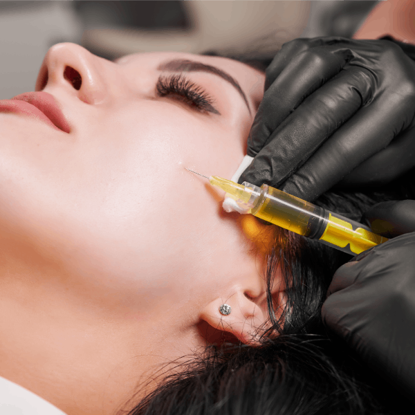 PRP Facial Rejuvenation