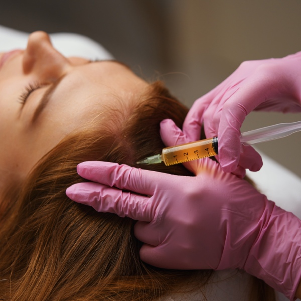 PRP Hair Therapy