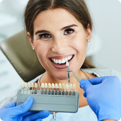 E-max Veneer