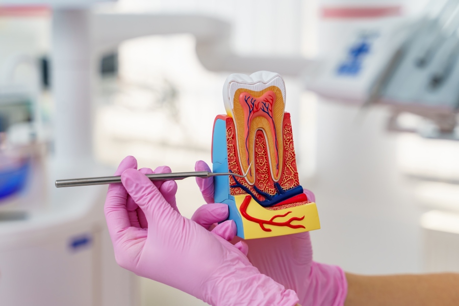 Root Canal Treatment 1