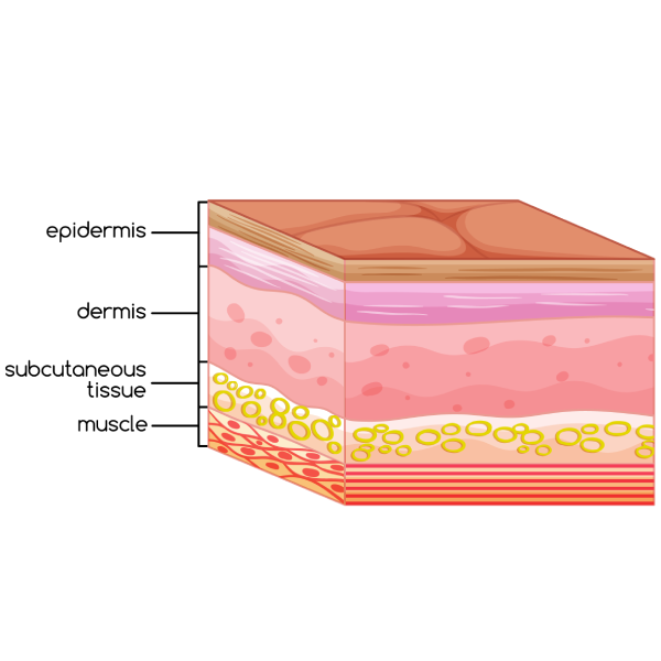 Laser Skin Resurfacing