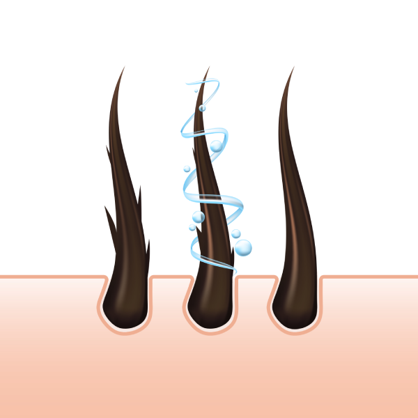 No-Shave Hair Transplantation