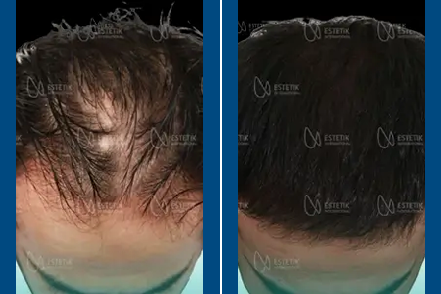 Regenera Activa: Revitalize Your Roots