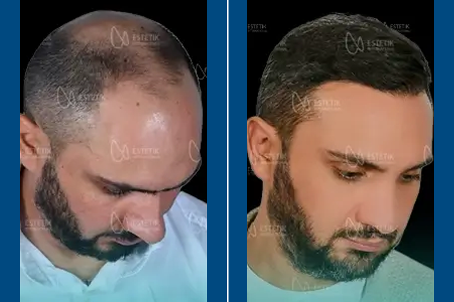 Regenera Activa: Revitalize Your Roots