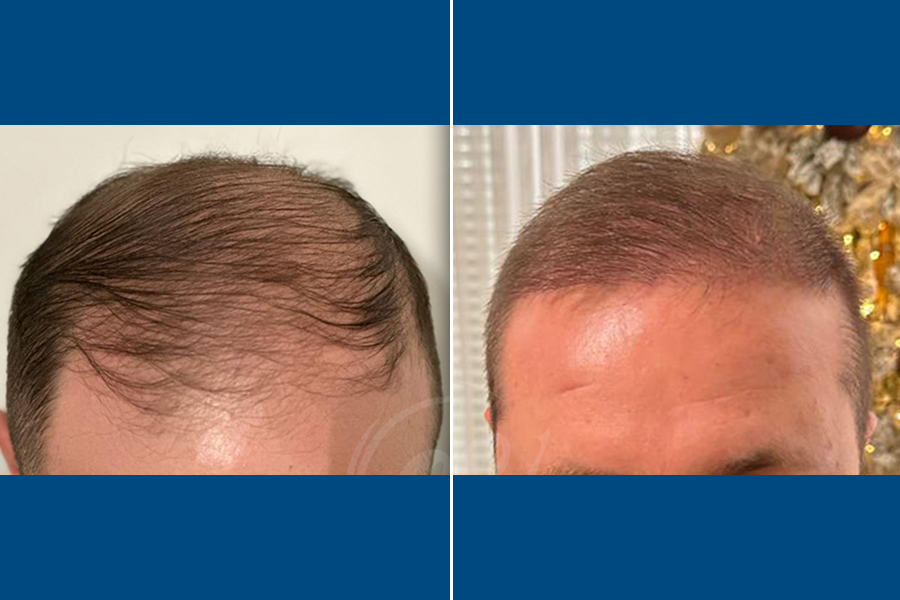 Regenera Activa: Revitalize Your Roots