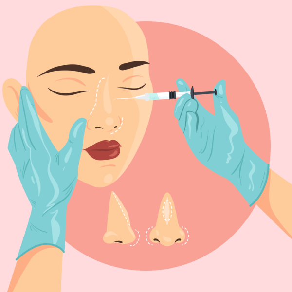 Revision Rhinoplasty