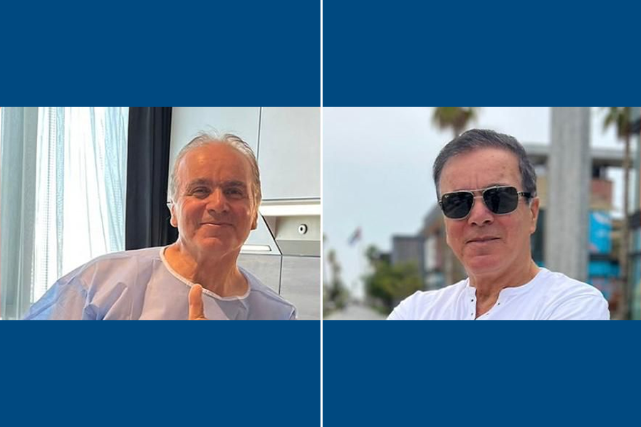 SDHI Hair Transplantation: Restore Fuller Hair