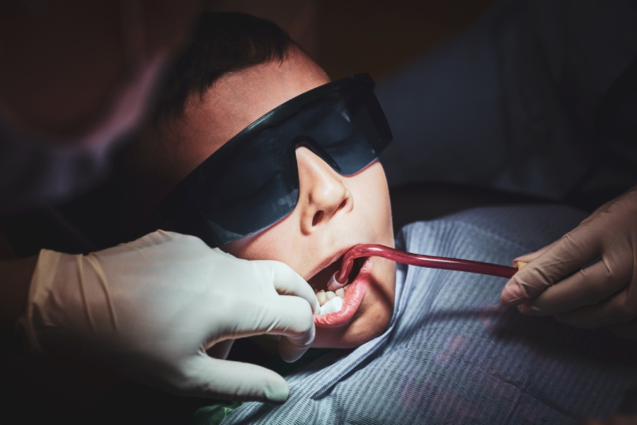 Wisdom Tooth Extraction 4
