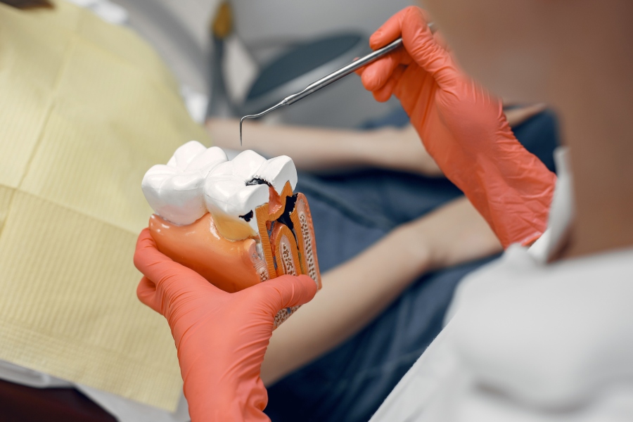 Wisdom Tooth Extraction 1
