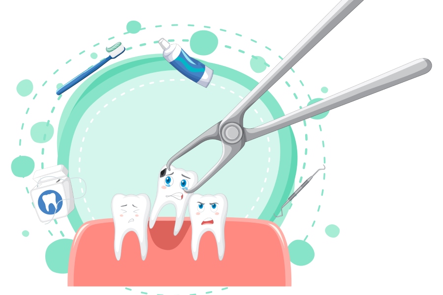 Wisdom Tooth Extraction 2