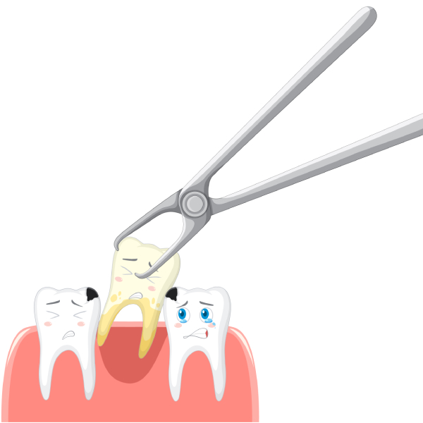 Wisdom Tooth Extraction